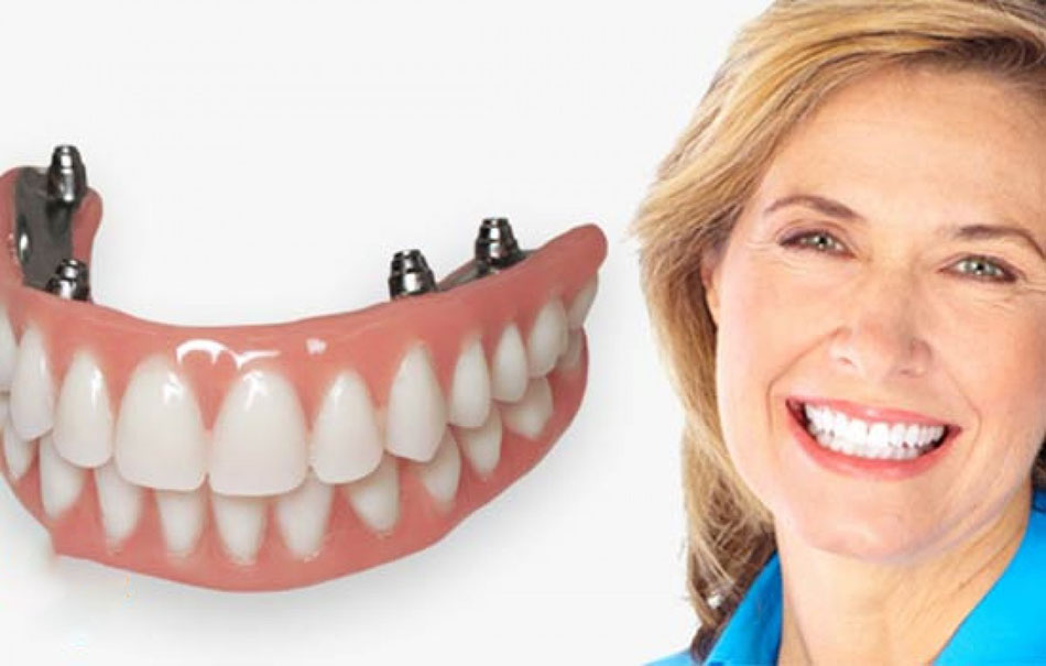 جایگزین دندان با ایمپلنت