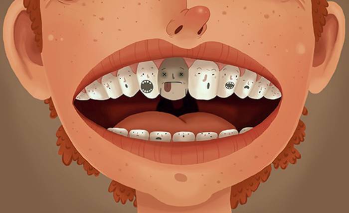 پر کردن دندان