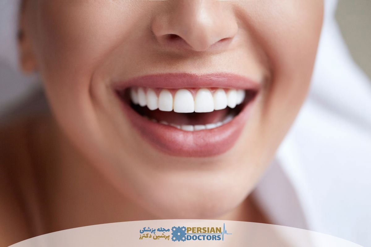 بهترین روش سفید کردن دندان در خانه بدون آسیب به مینای دندان