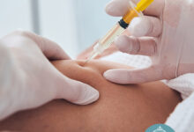 تزریق فیلر بادی