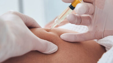 تزریق فیلر بادی