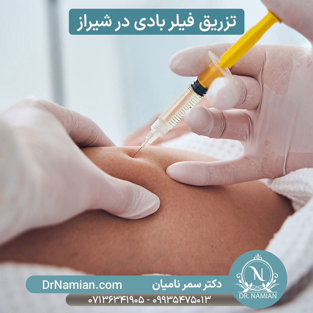 تزریق فیلر بادی