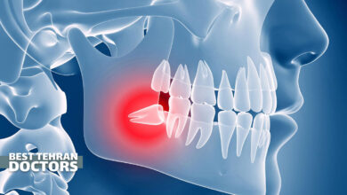 درمان درد دندان عقل نهفته بدون جراحی شامل چه روش هایی است؟