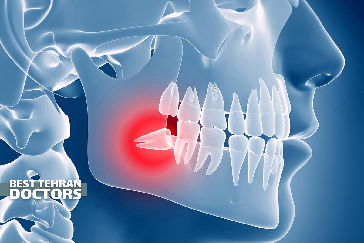 درمان درد دندان عقل نهفته بدون جراحی شامل چه روش هایی است؟